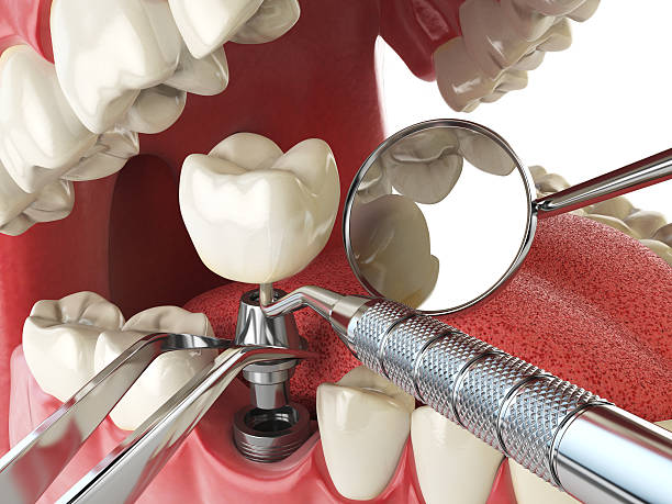 Best After-Hours Emergency Dentist in Montgomery, IN